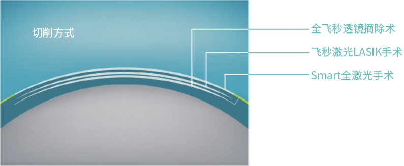 1551859632640610.jpg smart全激光2.jpg