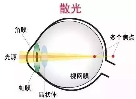 散光的原理.jpg
